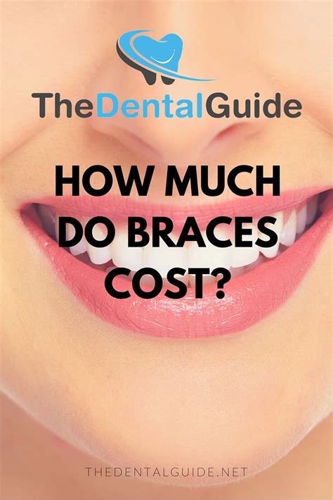 braces pay monthly uk.